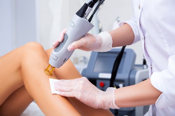 Laser Hair Removal Technicians in Texas Bertolino