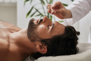 man receiving acupuncture